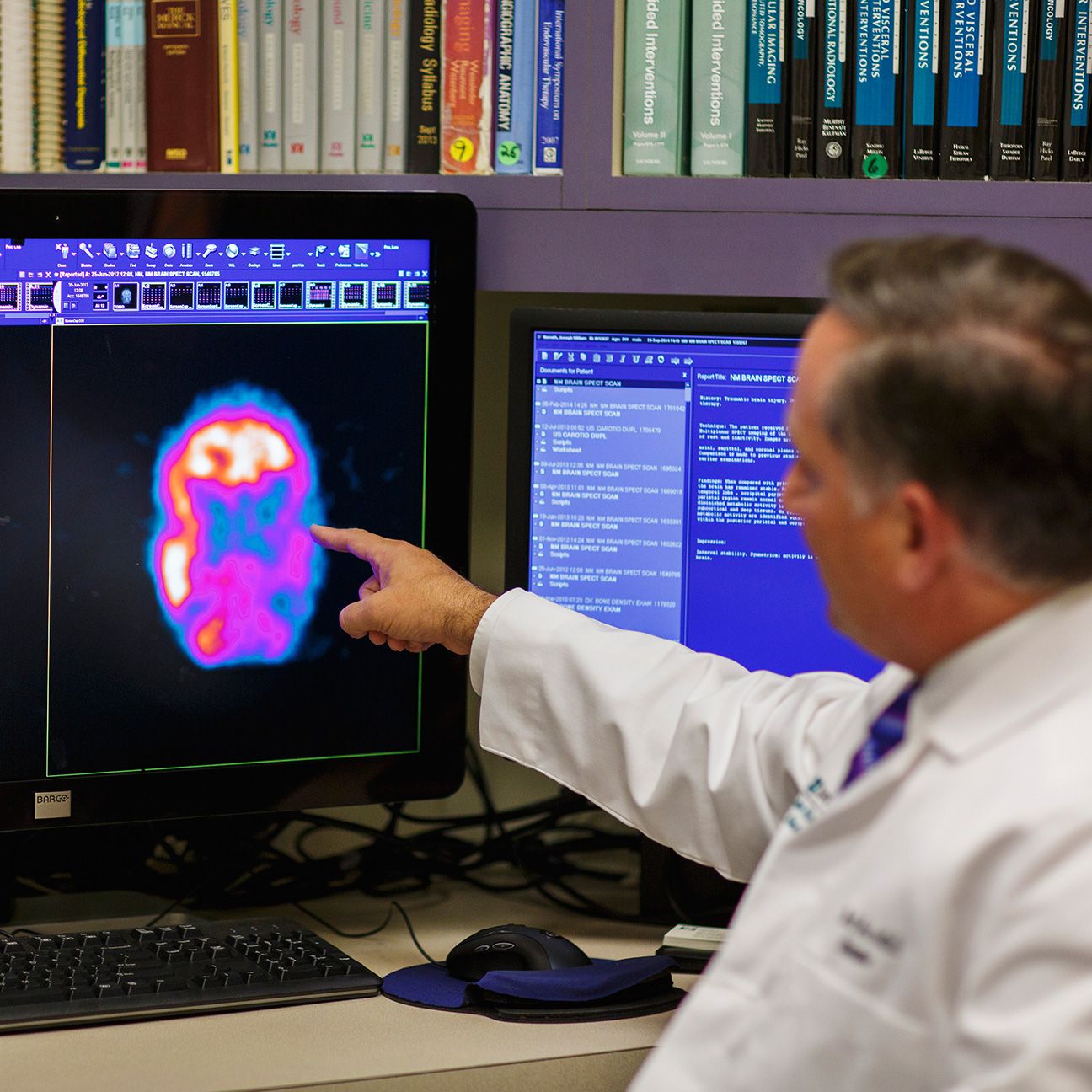 Report: CTE found in 87 of 91 deceased players