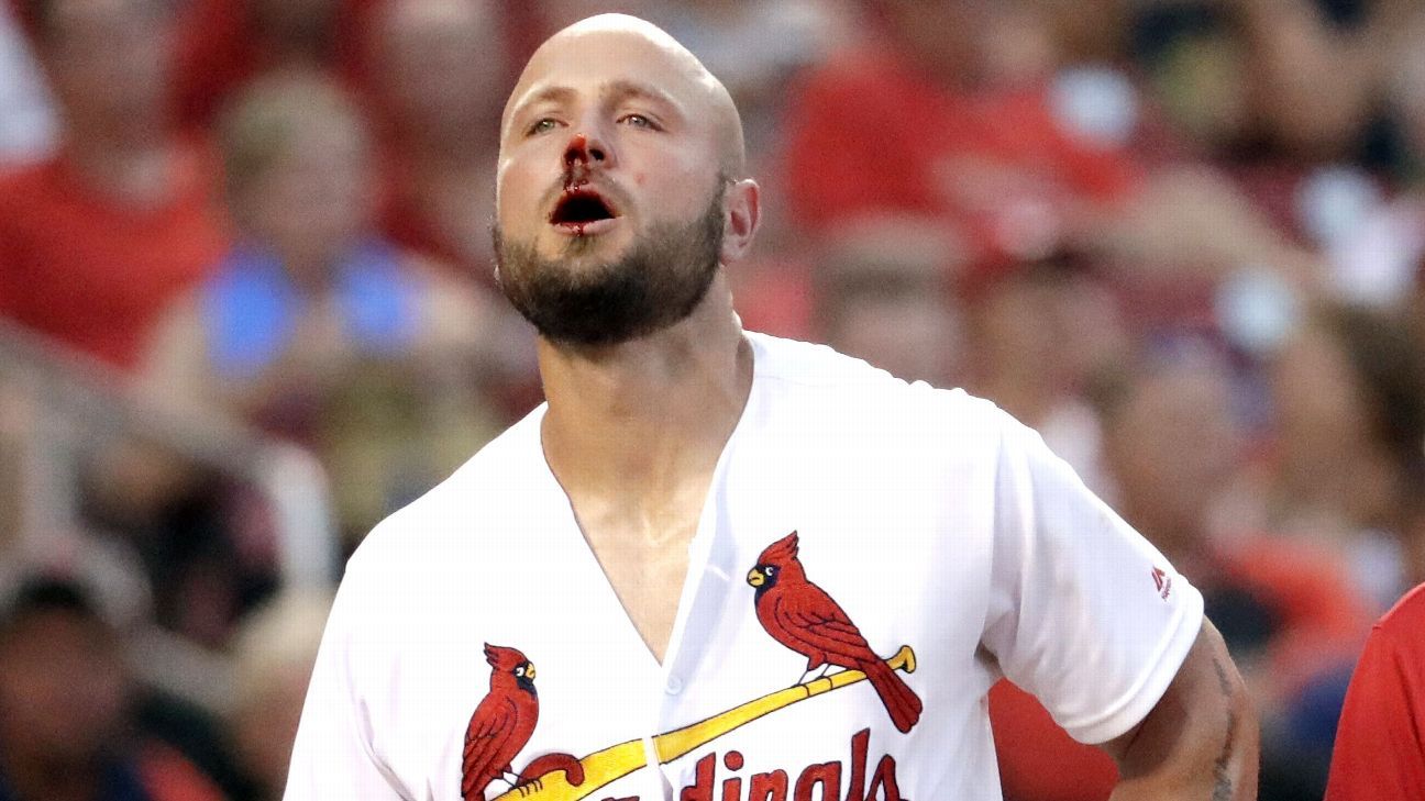 Matt Holliday of St. Louis Cardinals leaves San Diego Padres game after being hit by pitch