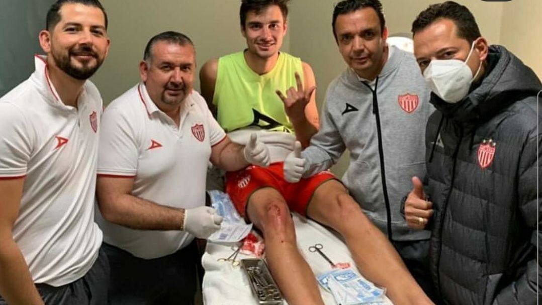 Unai Bilbao del Necaxa bromea con su lesión: 