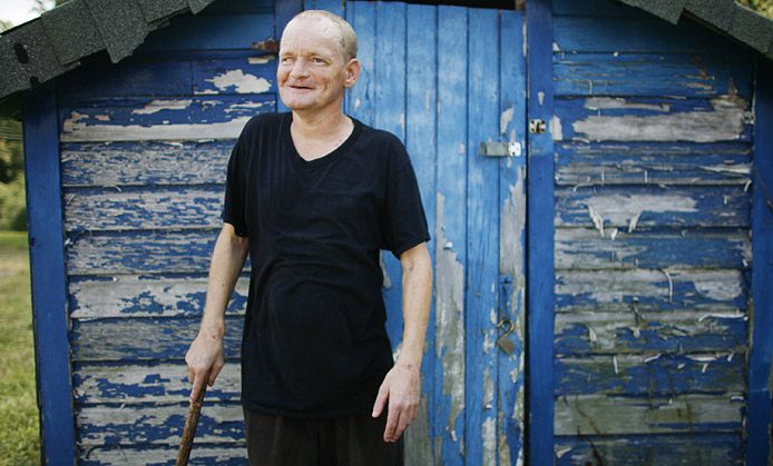The challenges of David�s past have left him with one eye and a left leg that is three inches shorter than the right.