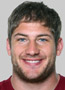Washington Redskins Chris Cooley faces surgery; return up in air