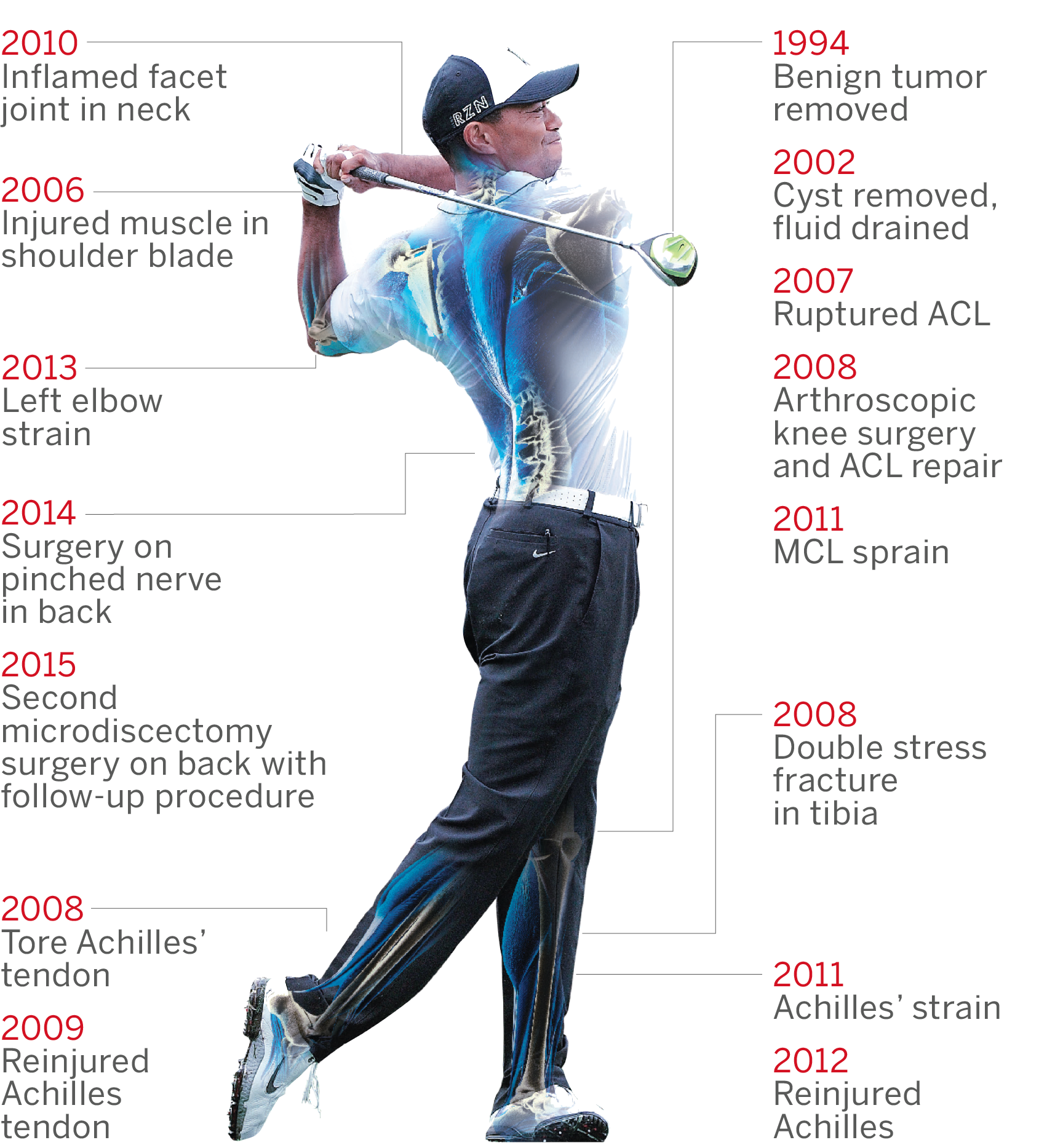 Tiger Woods' injury timeline ABC News