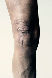John Force's right knee