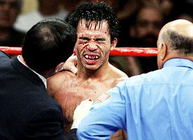 Manny Pacquiao