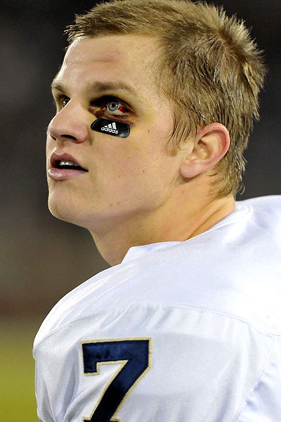 What Will Jimmy Clausen Do? (Follicularly Speaking) - SportsCenter.