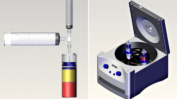 Centrifuge 