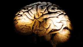Estudio Cerebro