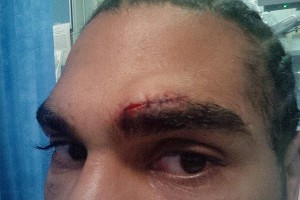 David Haye