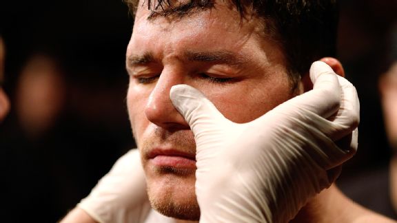 Michael Bisping