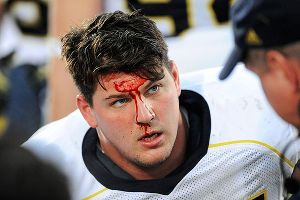 Taylor Lewan
