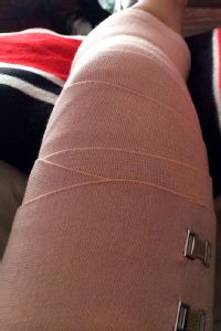 Anna Wilson Knee