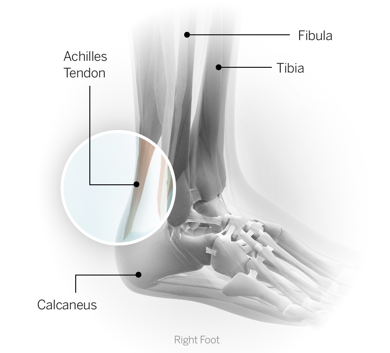 What is the average time a foot takes to fully recover from surgery?