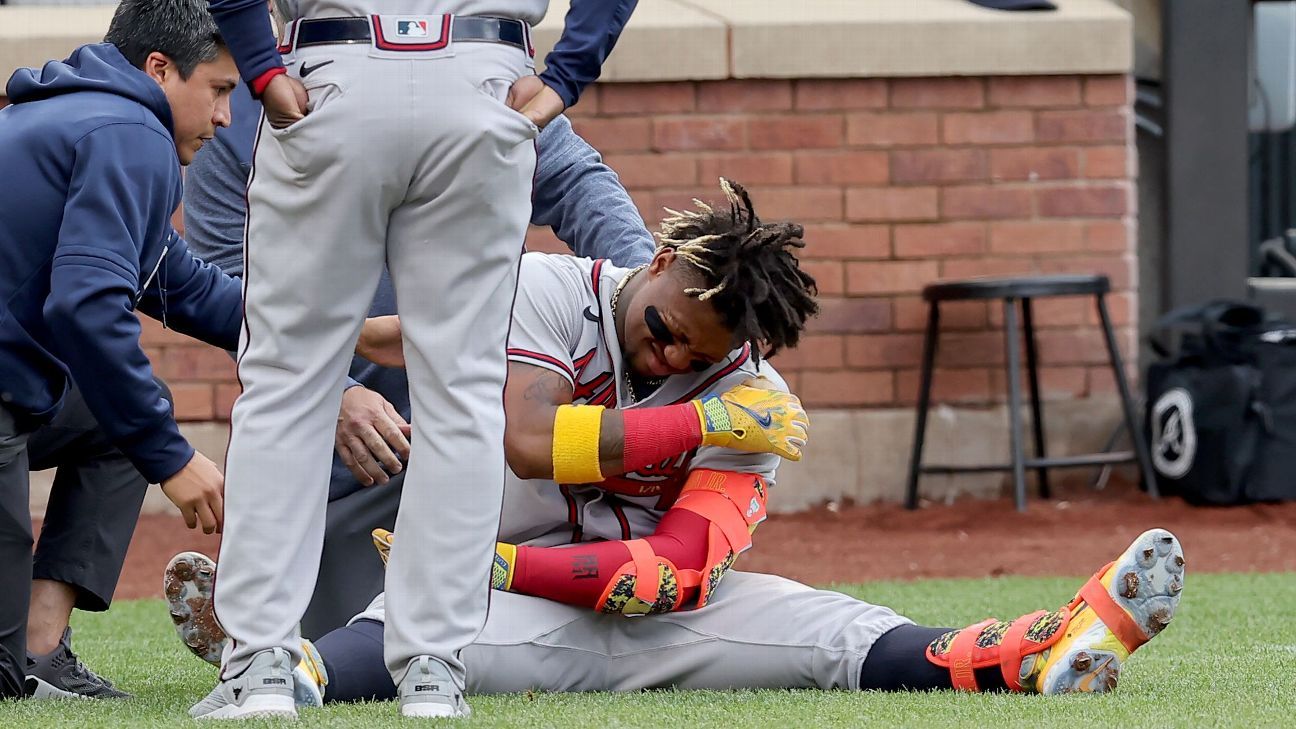 Braves' Ronald Acuna day to day after being hit by pitch