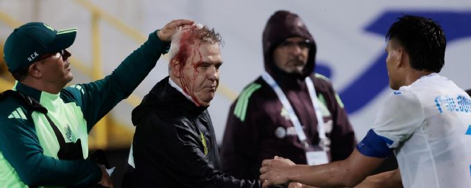 Mexico's Aguirre bloodied after being hit with a can of beer