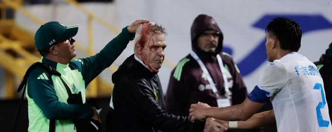 Mexico coach Aguirre hit in head by beer can after loss in Honduras