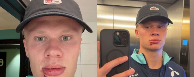 Erling Haaland requires stitches after Norway 'bus door' incident