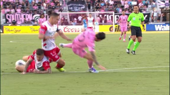 Messi leaves with injury as Inter Miami rally to win in PKs