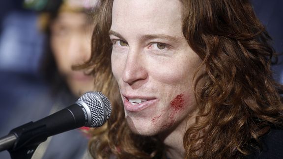 shaun white long hair