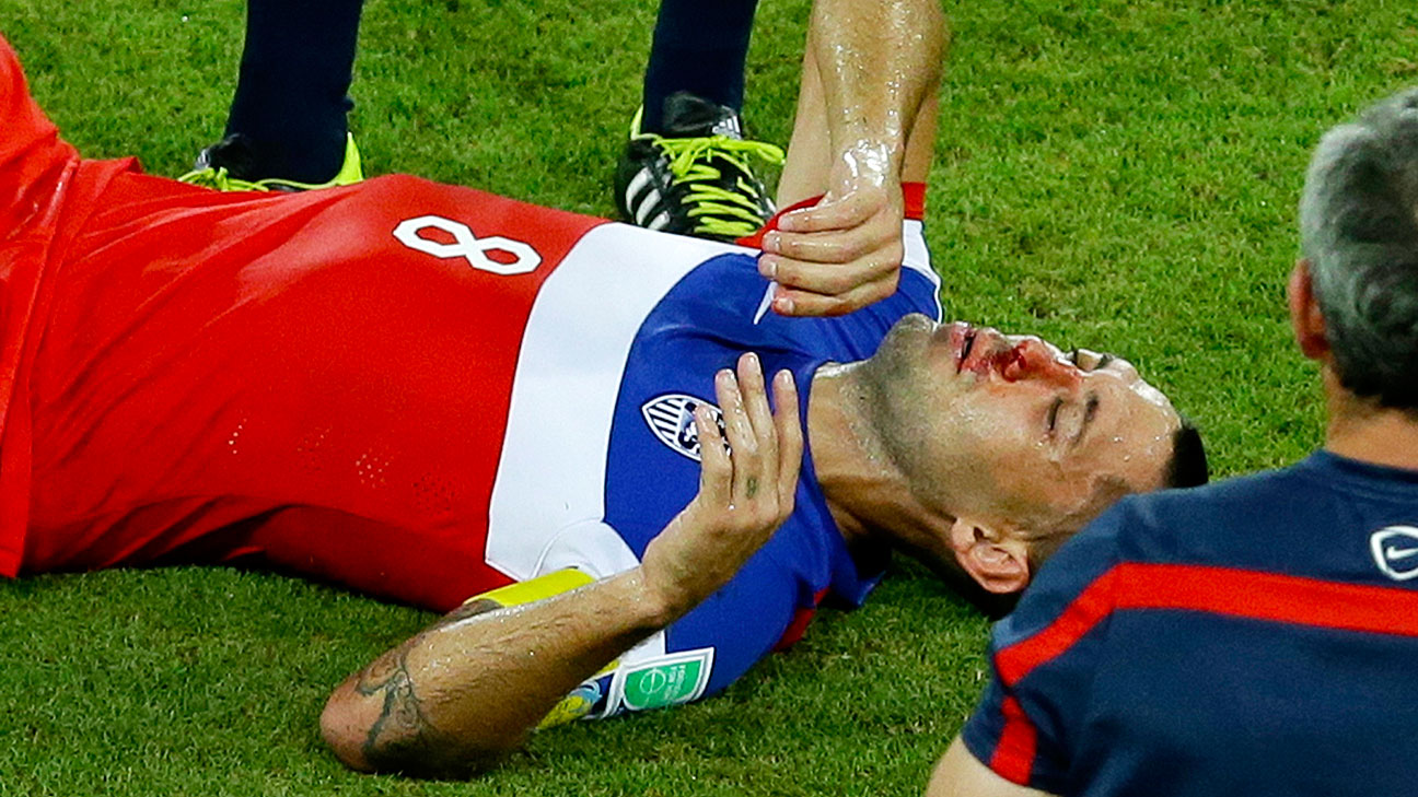 Clint Dempsey broke his nose but is expected to play vs. Portugal