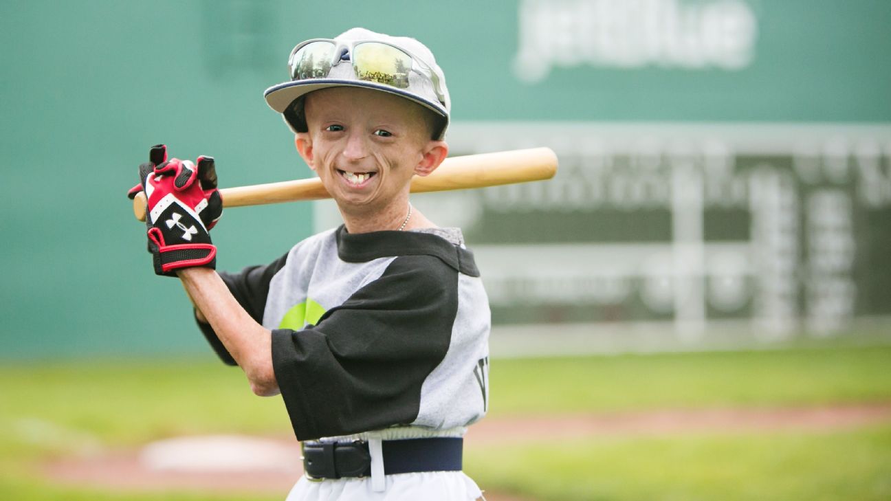 Old Time Family Baseball — Before laser eye surgery, there was