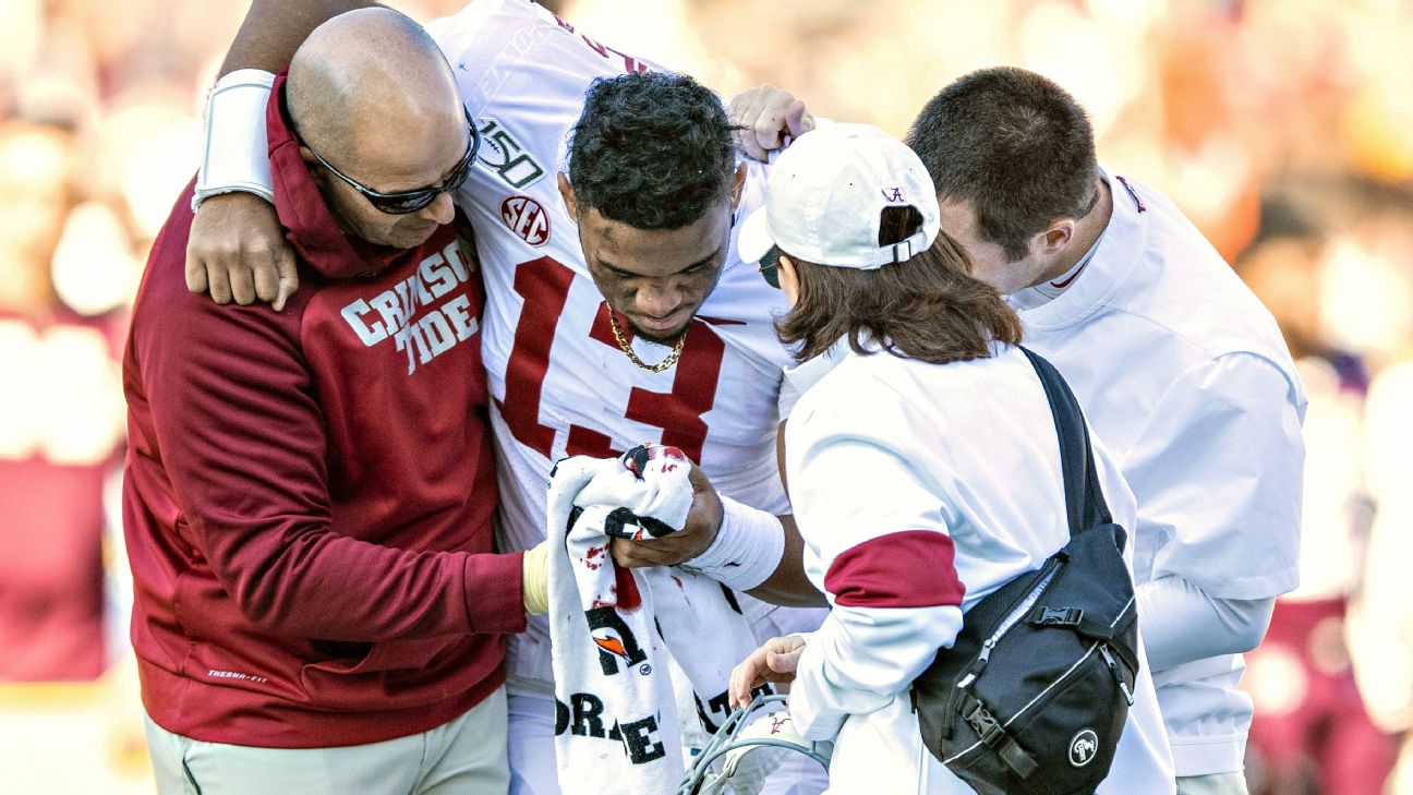 Tua Tracker: Tua Tagovailoa battles through back injury to lift