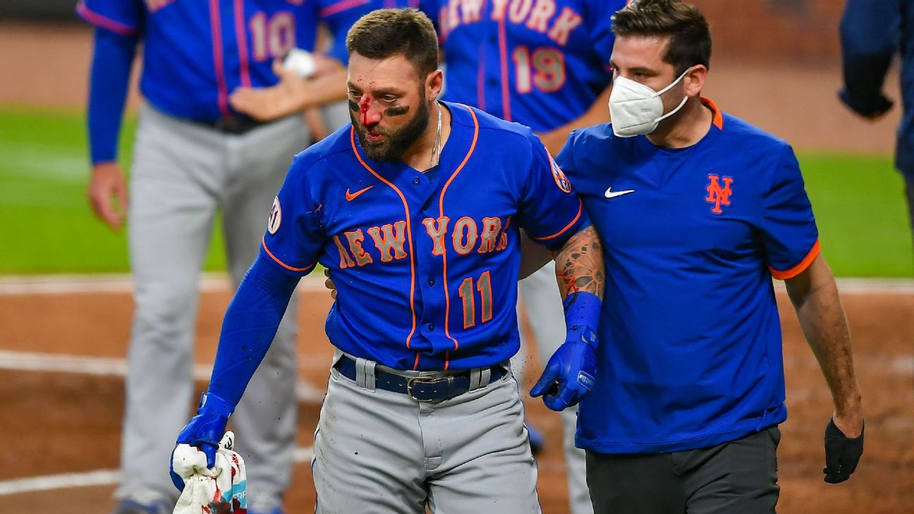 Video Baseball player Kevin Pillar hit in face - ABC News