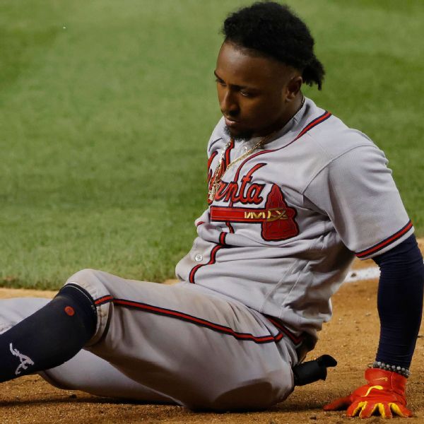 Braves 2B Albies fractures left foot during swing