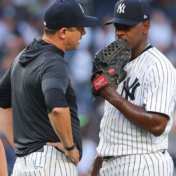 Yanks' Severino not expected to throw for 2 weeks thumbnail