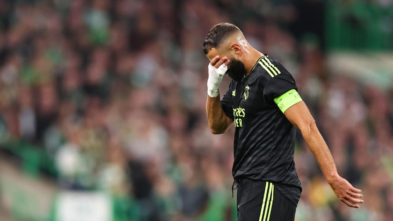 Striker Real Madrid Karim Benzema akan absen selama sebulan karena cedera