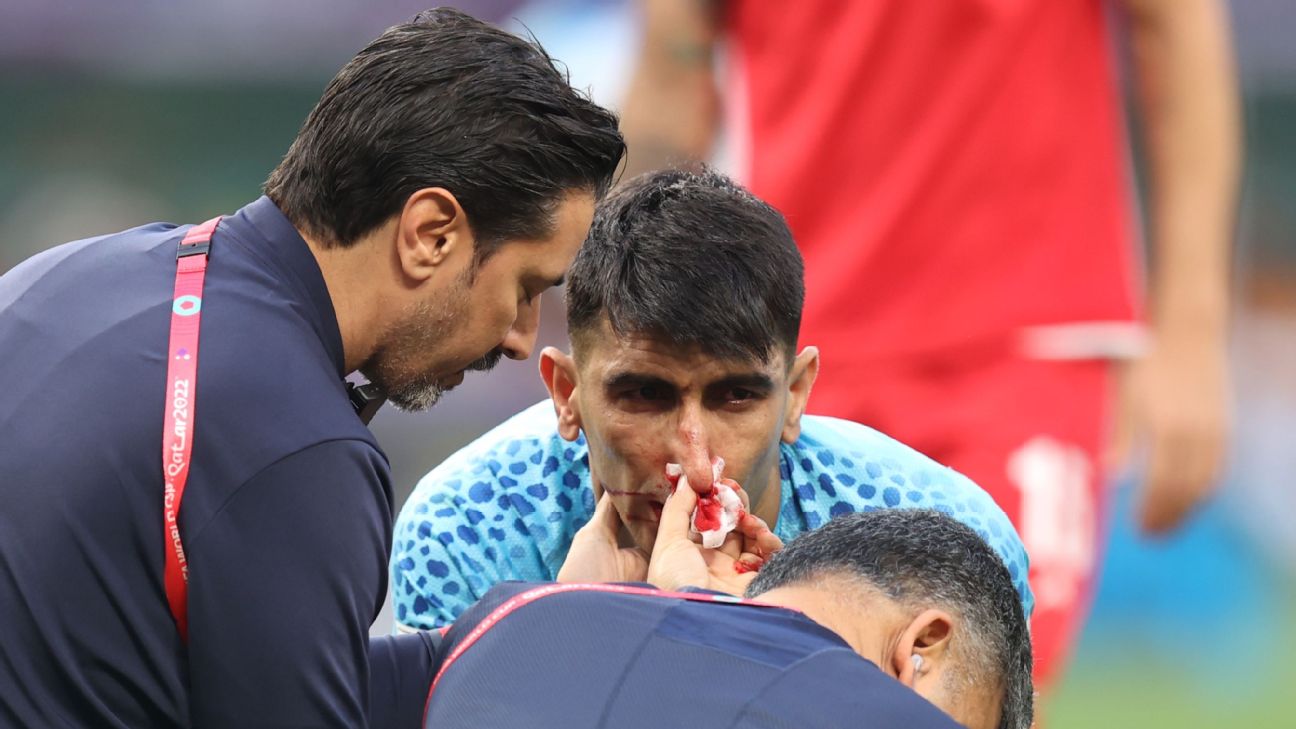 GOLEIRO do IRÃ vai a NOCAUTE e é substituído contra a INGLATERRA