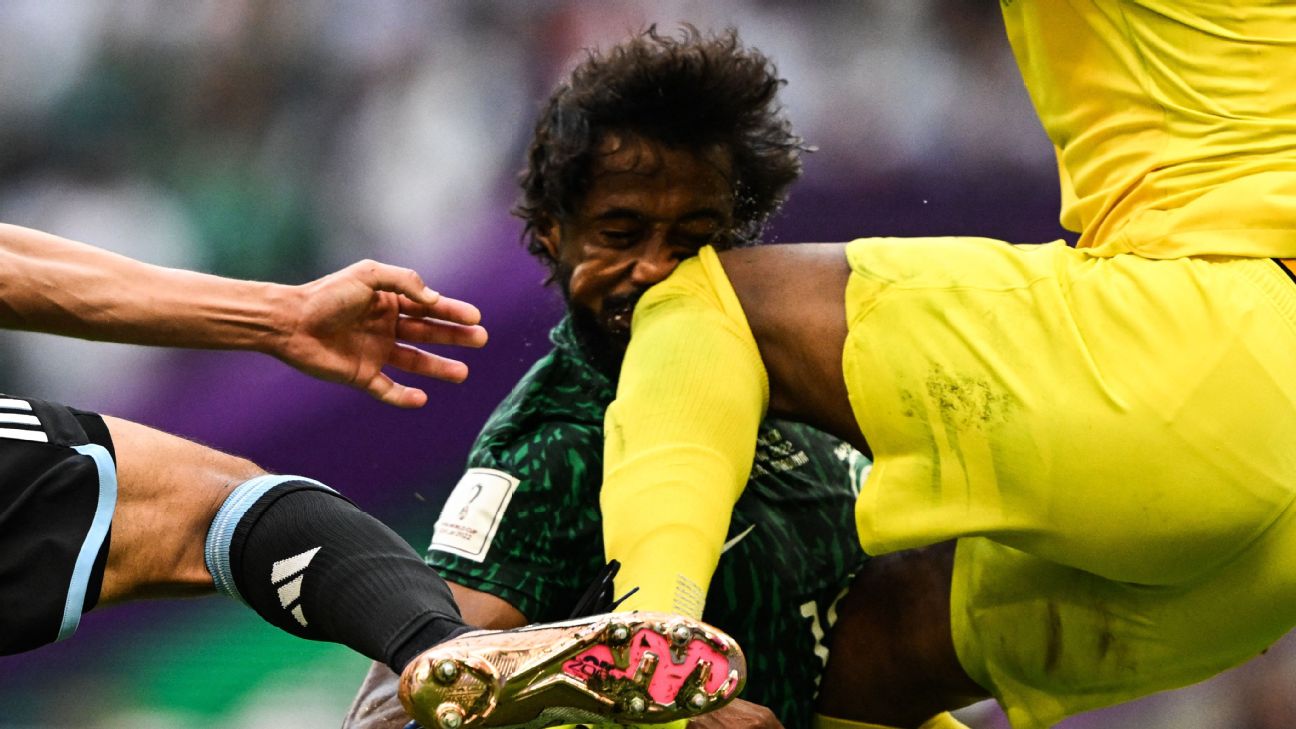 Meia iraniano tem fratura chocante na perna e sonho da Copa de 2014 está  sob risco - Esporte - Extra Online