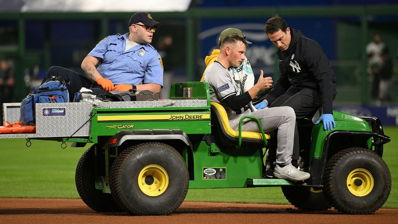 Yankees reliever Anthony Misiewicz struck in the face by a line