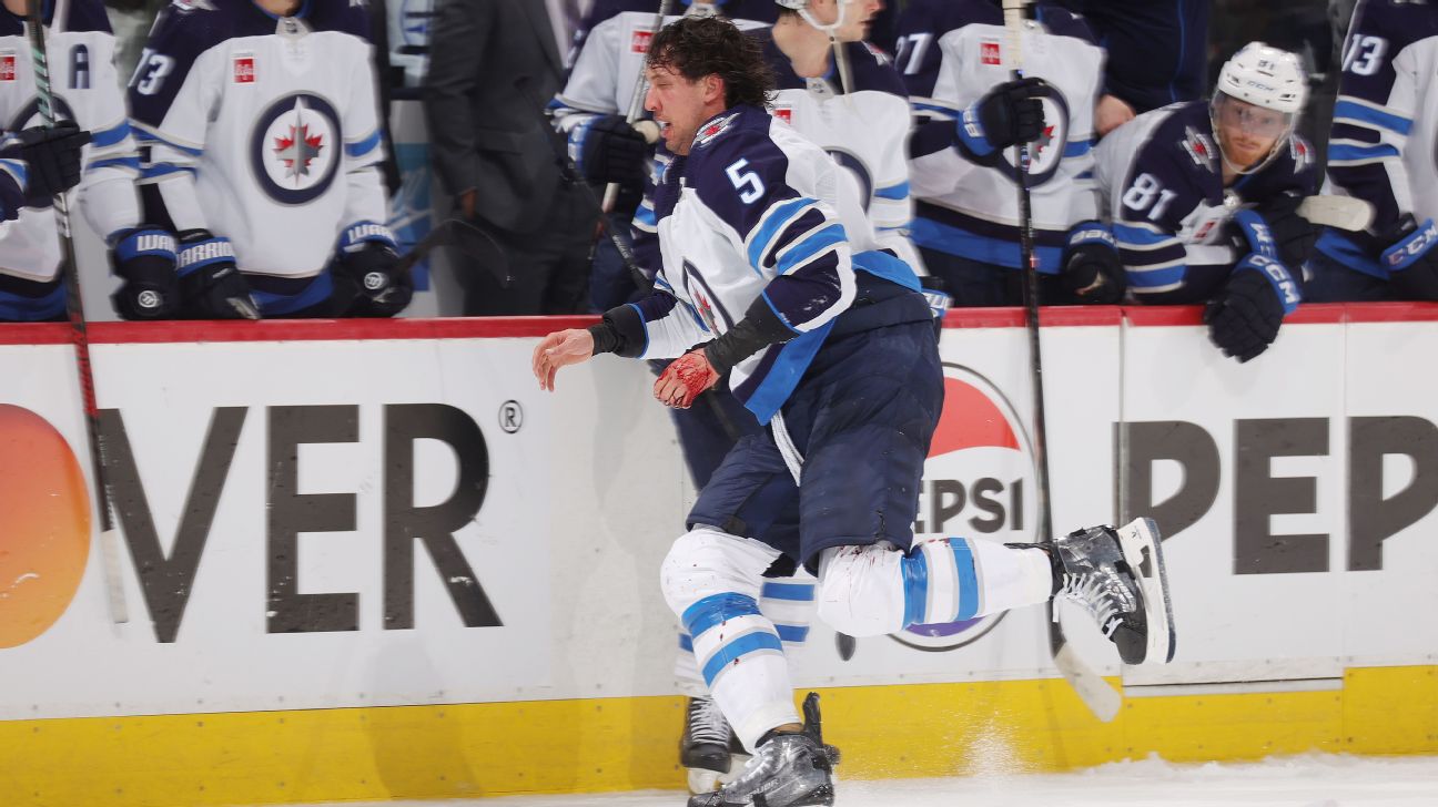 Jets D Brenden Dillon misses Game 4 with lacerated hand